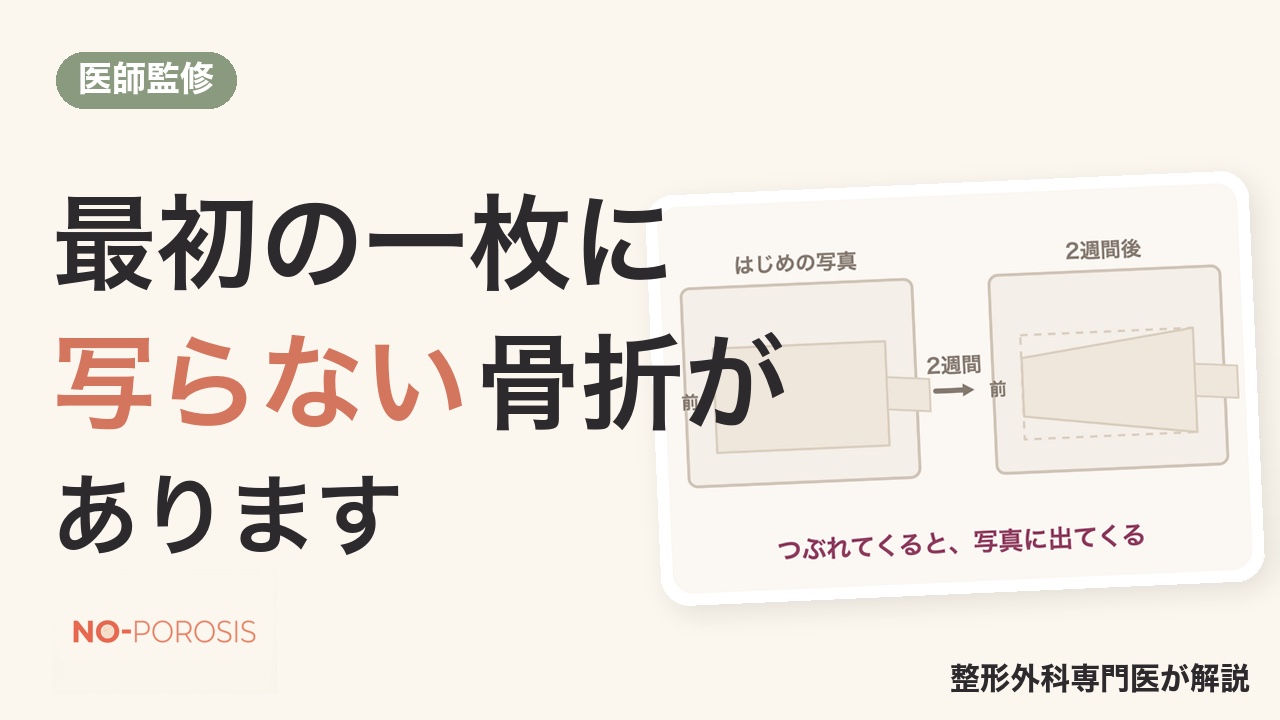 圧迫骨折は、最初のレントゲンに写らないことがあります